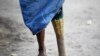 Oo Taung, 50, who lost his leg in a land mine blast in 1994 stands after taking a bath in Zawti village in Kyaukki township January 24, 2013. More than 300 people in Kyaukki Township (population 115,200) in Northern Bago Division, adjacent to once war-tor (ယခင္မွတ္တမ္းဓါတ္ပုံ)