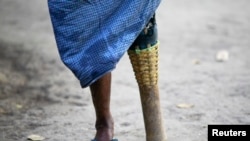 မိုင်းကြောင့် ခြေတဘက် ဆုံးရှုံးခဲ့သူတဦး (မှတ်တမ်းဓာတ်ပုံ-ဇန်နဝါရီ၊ ၂၄၊ ၂၀၁၃)