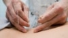 A Crisis in Pain Drugs Leads to Greater Use of Acupuncture