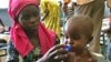 نگرانی ملل متحد راجع به اطفال قحطی زده در سومالیا