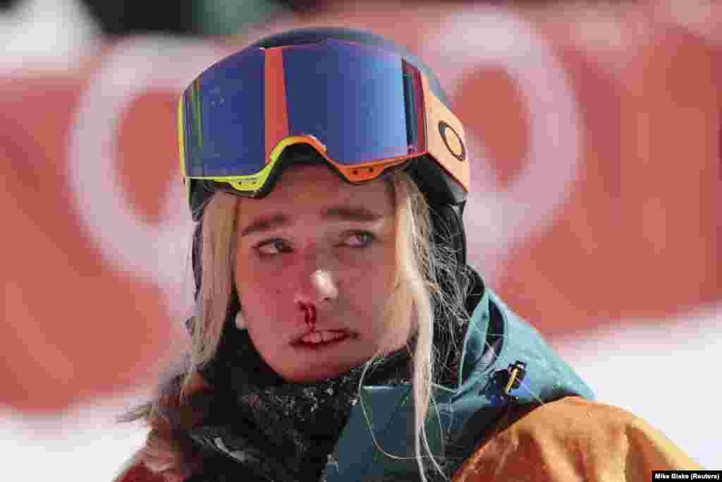 Сноубордистка Емілі Артур з Австралії після падіння, яке сталося під час її останнього змагання у жіночій дисципліні з хаф-пайп 13 лютого, 2018 року.