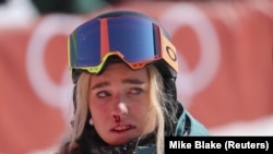 Сноубордистка Емілі Артур після невдалого спуску на сноуборді.