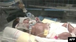 Preveremeno rođena beba u inkubatoru