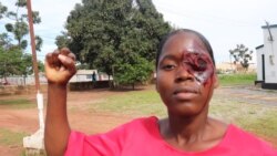 Angola: Crimes passionais aumentam e exigem respostas urgentes - 17:45