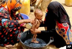 FILE - A severely malnourished infant is bathed in a bucket in Aslam, Hajjah, Yemen, Aug. 25, 2018.