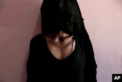 Umm Mizrah, a 25-year-old Yemeni mother, reveals her collarbones and emaciated ribs to be photographed at Al-Sadaqa Hospital in Aden, Yemen, Feb. 13, 2018.