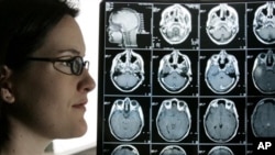 FILE - Kyla Nagel stands next to her brain scan at her home in Springfield, Ore. Nagel was diagnosed with an aggressive brain cancer.