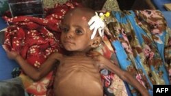 Дитина із симптомами недоїдання в Африканському Розі