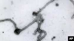This undated photo made available by the Antwerp Institute of Tropical Medicine in Antwerp, Belgium, shows a black and white image of the Ebola virus viewed through an electron microscope. Scientists at the University of California, San Diego produced the first color image from an electron microscope.