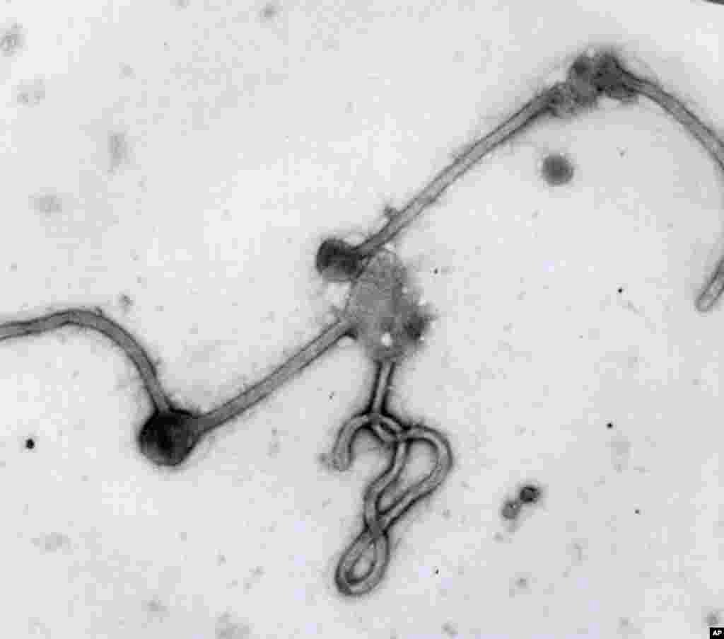 This undated photo made available by the Antwerp Institute of Tropical Medicine in Antwerp, Belgium, shows the Ebola virus viewed through an electron microscope. The World Health Organization on Aug. 8, 2014 declared the Ebola outbreak in West Africa to be an international public health emergency that requires an extraordinary response to stop its spread.