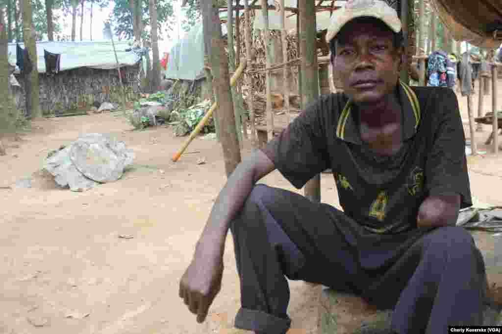 Avec son bras gauche coupé, ce déplacé vit avec sa famille dans un des camps à Oicha, Beni, 28 octobre 2015 (Charly Kasereka/VOA).