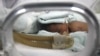 Tingkat Keselamatan Bayi Prematur di AS Meningkat