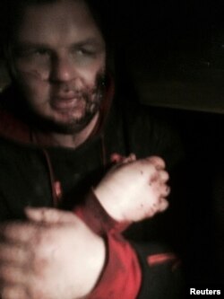 Dmytro Bulatov, one of the leaders of anti-government protest motorcades called 'Automaidan', is seen just after being found near Kyiv, Jan. 30, 2014.