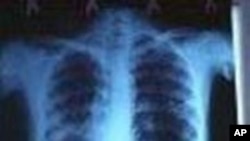 Tens of Millions of TB Patients Cured
