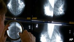 Radiolog koristi lupu kako ne bi propustio da otkrije rak dojke dok pregleda mamograme 