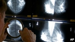 FILE - A radiologist uses a magnifying glass to check mammograms for breast cancer in Los Angeles, California, May 6, 2010.