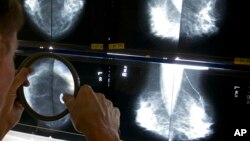 FILE - A radiologist uses a magnifying glass to check mammograms for breast cancer in Los Angeles, California, May 6, 2010.