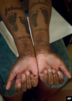 FILE - In this May 22, 2015 photo, Candie Hailey shows her inner forearms with footprint tattoos for her two sons along with their names, and scars on both wrists she says came from suicide attempts while confined at Rikers Island in New York.