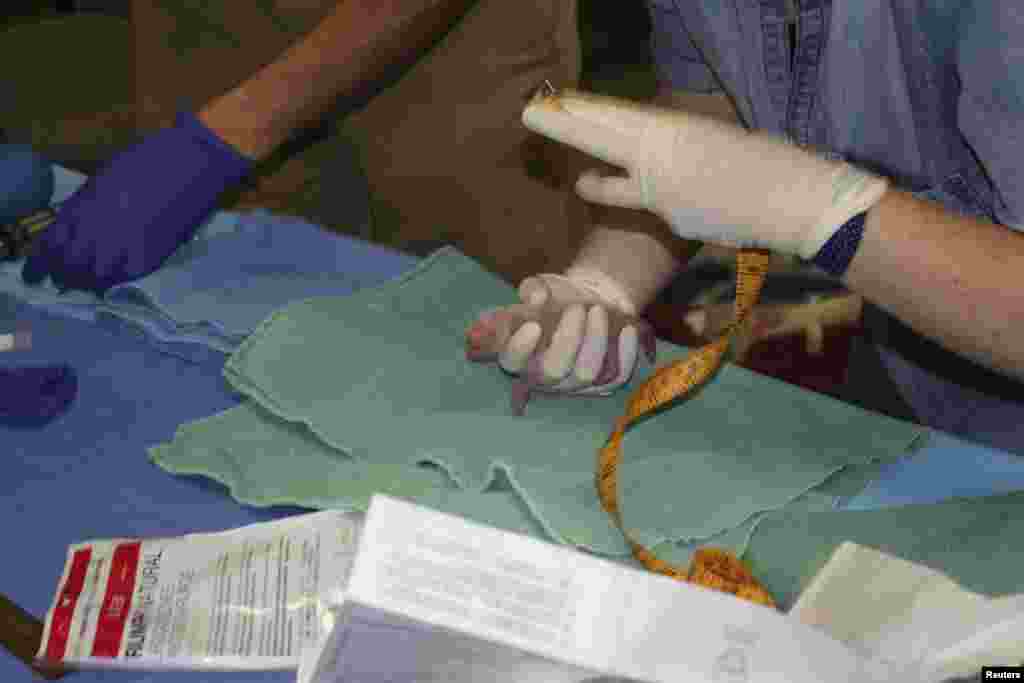 One of the giant panda cubs born at the Smithsonian National Zoo is being examined by veterinarians in this image taken in Washington, DC, Aug. 22, 2015.