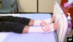 Sam Kanizay se recupera en un hospital de Melbourne, Australia, luego de haber sido atacado por diminutas criaturas marinas carnívoras que atacaron sus pies y la parte inferior de las piernas.
