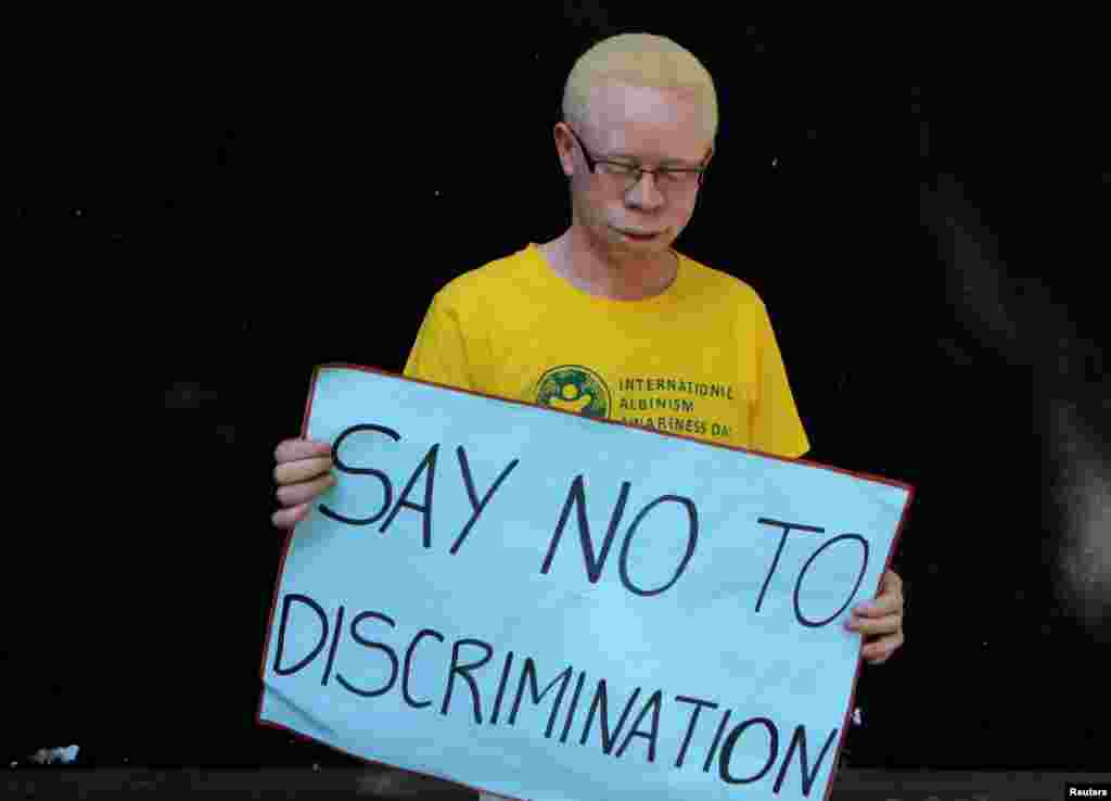 Un Albinos porte une pancarte "Dites non à la discrimination" lors d'une campagne de sensibilisation à Harare, Zimbabwe, le 18 juin 2016. Lire l'article ici.