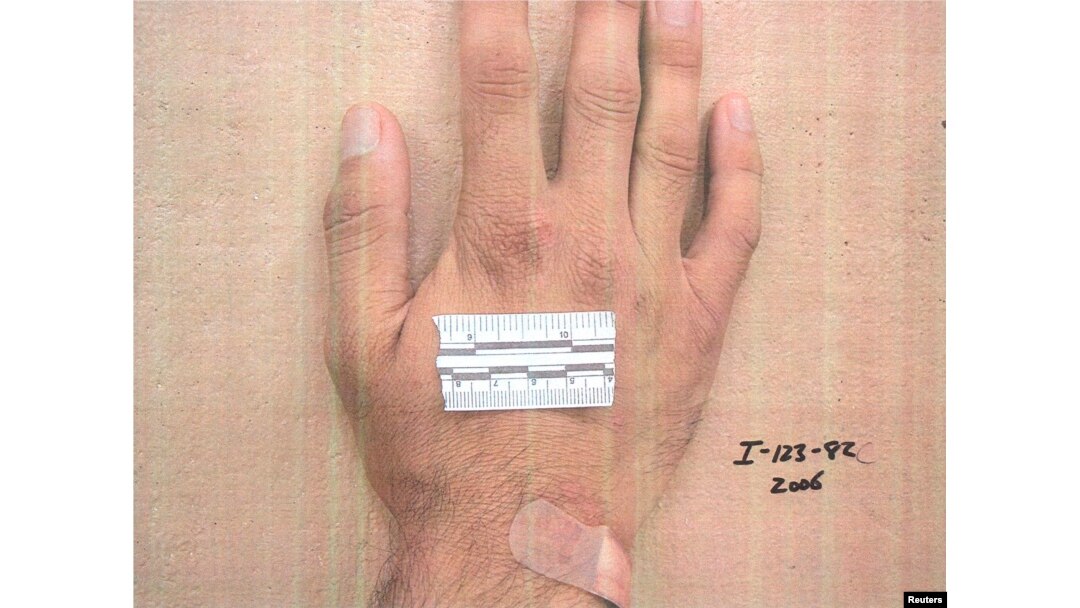 A measurement strip lies on the hand of a detainee in an undated photo from Iraq's Abu Ghraib prison, among 198 images released in a Freedom of Information Act lawsuit against the U.S. Department of Defense in Washington, D.C., Feb. 5, 2016.