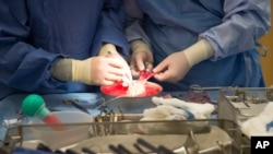 Surgeons work on a kidney during a kidney transplant surgery at MedStar Georgetown University Hospital in Washington D.C., Tuesday, June 28, 2016. (AP Photo/Molly Riley)