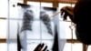 Drug Combo Could Advance Fight Against Multi-Drug-Resistant TB