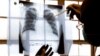 Medical Organizations Unite to Battle 'Multi-Drug' TB