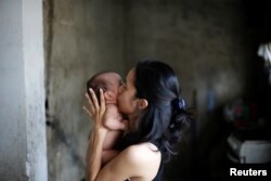 FILE - Yennifer Padron kisses her baby in her house at Petare slum in Caracas, Venezuela, Aug. 21, 2017.