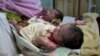 پاکستان میں نومولود بچوں کی شرح اموات سب سے زیادہ: رپورٹ