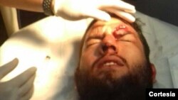 El diputado por Primero Justicia, Juan Requesens, resultó herido en la ceja izquierda cuando un grupo violento atacó la protesta que realizaban los parlamentarios en la sede de la Defensoría del Pueblo.