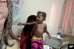 Umm Molham, a Yemeni mother who is herself undernourished, struggles to hold up her malnourished 13-month-old son Molham at the Ibn Kholdoon Hospital, in Lahj, Yemen, Feb. 11, 2018.