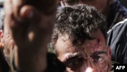 A wounded fighter is brought into a the Ras Lanuf Hospital from the battle in Bin Jawad on March 6, 2011, as tanks shell the center of rebel-held Misrata.