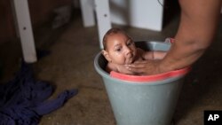 Un niño en Poco Fundo, Pernambuco, Brasil, nacido con hidrocefalia, después de que su madre fue infectada con el virus Zika a causa de una picadura de mosquito.