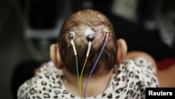 Ce bébé de cinq mois passe des tests à l'Université de Sao Paulo, Brésil, 28 avril 2016. 