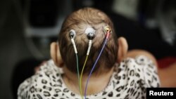 Five-month-old Laura undergoes a medical test at the University of Sao Paulo in Sao Paulo, Brazil on April 28, 2016. Among the mysteries facing doctors in Brazil battling an epidemic of the little-known Zika virus are cases of women giving birth to twins with only one suffering from microcephaly, a birth defect associated with the disease. (REUTERS/Nacho Doce)