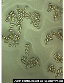 There are more microbial cells in a person's body than human cells. The microbes in the human body include bacteria, viruses and fungi, like this fungal spore bacteria in water.