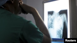 FILE - A doctor examines the X-ray of a patient's heart, April 15, 2012. A new study shows vitamin D3 can significantly improve cardiac function in people with chronic heart failure.