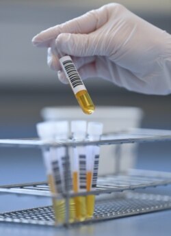 Seorang teknisi di Rumah Sakit Pendidikan Erlangen memeriksa sampel plasma darah yang bisa digunakan untuk mengobati pasien virus corona, April 2020. (Foto: Reuters/Ilustrasi)