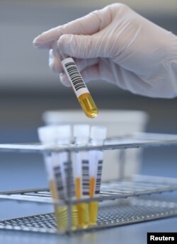 Seorang teknisi di Rumah Sakit Pendidikan Erlangen memeriksa sampel plasma darah yang bisa digunakan untuk mengobati pasien virus corona, April 2020. (Foto: Reuters/Ilustrasi)