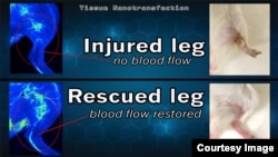 This graphic shows the results of a breakthrough discovery called tissue nano-transfection. In laboratory tests at The Ohio State University Wexner Medical Center, researchers were able to heal the badly injured legs of mice in just three weeks, with no other treatments, simply by touching the legs once with a high-tech silicone chip. (Photo courtesy of The Ohio State University Wexner Medical Center)