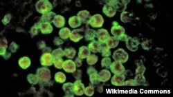 Naegleria fowleri atau ameba pemakan otak. (Foto: CDC/Dr. Govinda S. Visvesvara)
