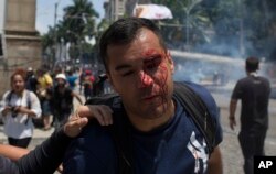 A bleeding demonstrator leaves after protesting near Rio de Janeiro's legislative assembly building, where lawmakers are considering austerity measures, Wednesday, November 16, 2016.