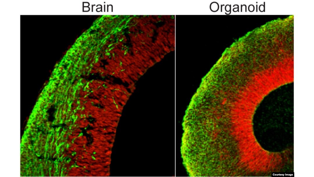 Comparison of the organoid (right) to the developing brain (left, section of a mouse brain shown). Both show neural stem cells in red and neurons in green. (Credit: Marko Repic and Madeline A. Lancaster)