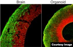 Comparison of the organoid (right) to the developing brain (left, section of a mouse brain shown). Both show neural stem cells in red and neurons in green. (Credit: Marko Repic and Madeline A. Lancaster)