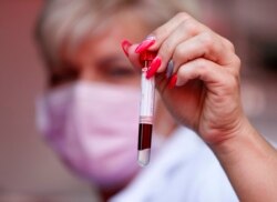 Seorang staf medis menunjukkan darah yang diambil dari seorang pasien lansia untuk tes antibodi di Budapest, Kamis, 8 Juli 2021. (AP)