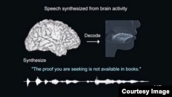 This image from video demonstrates how the process turns brain signals into synthesized speech. (University of California San Francisco via YouTube)