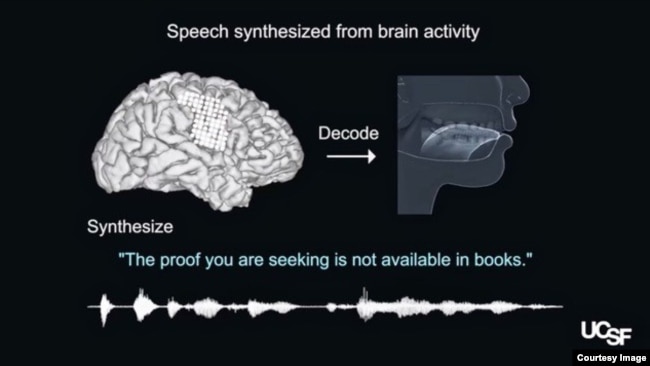 This image from video demonstrates how the process turns brain signals into synthesized speech. (University of California San Francisco via YouTube)