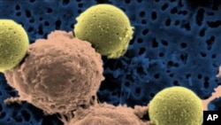 This microscopy image shows immune system T-cells, center, binding to beads which cause the cells to divide. The beads, depicted in yellow, are later removed, leaving pure T-cells which are then ready to inject in cancer patients. Scientists are reporting the first success with gene therapy to treat leukemia, using the patients' own blood cells to hunt down and wipe out their cancer. (AP Photo/Dr. Carl June).